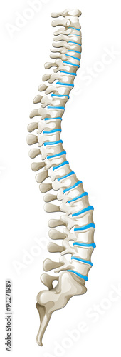 Spine diagram showing back pain