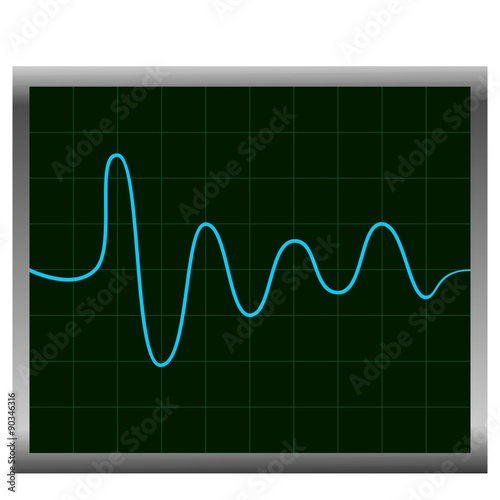 Normal ECG (electronic cardiogram) blue