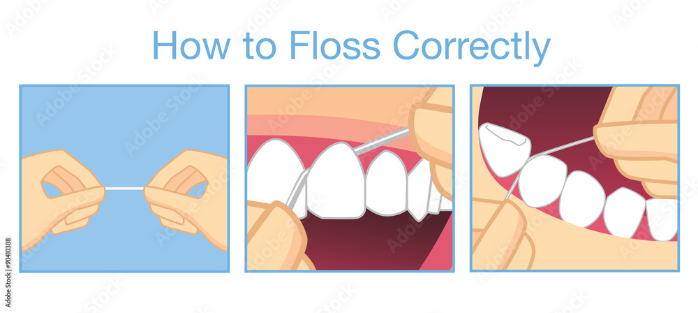 How to floss correctly for cleaning teeth