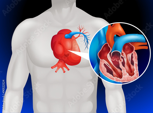 Heart disease diagram in detail