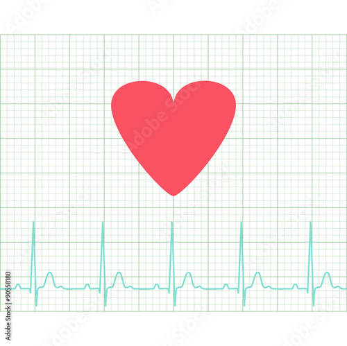 EKG - Medical electrocardiogram