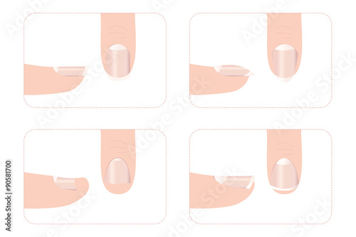 Different nail shapes with fingers 