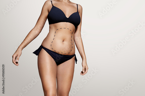 woman's body with a lines for liposuction