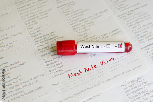 West Nile virus positive