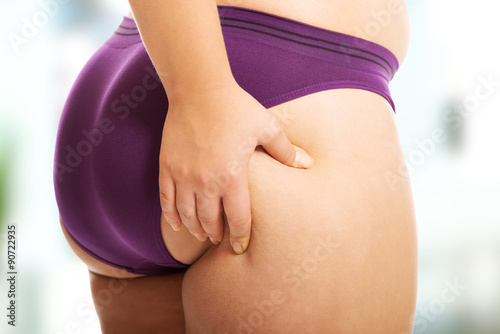 Slika na platnu Overweight woman checking her fat
