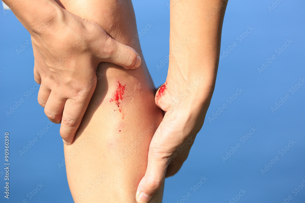 young sporty woman hold her sports injured leg young sporty woman hold her sports injured leg