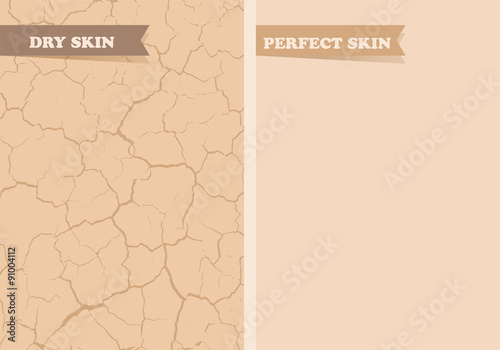 Dry skin, Perfect skin