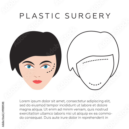 Plastic surgery infographics, vector illustration