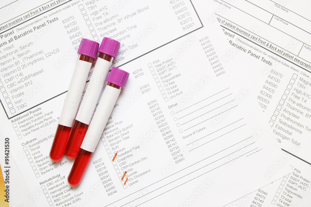 Blood Sample Blood Sample