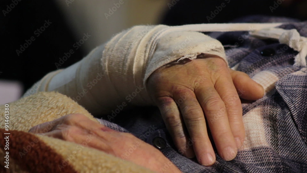 Bandaged broken arm of elderly man who lying in the hospital hall and waiting doctoral examining,hand close up. Bandaged broken arm of elderly man who lying in the hospital hall and waiting doctoral examining,hand close up.