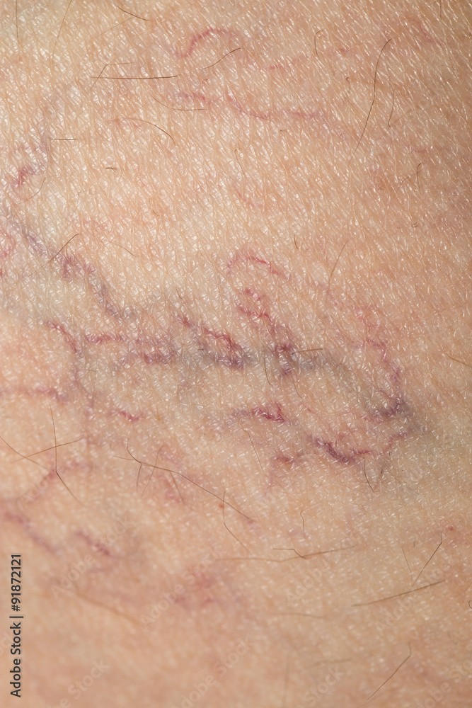 veins on the skin. close veins on the skin. close