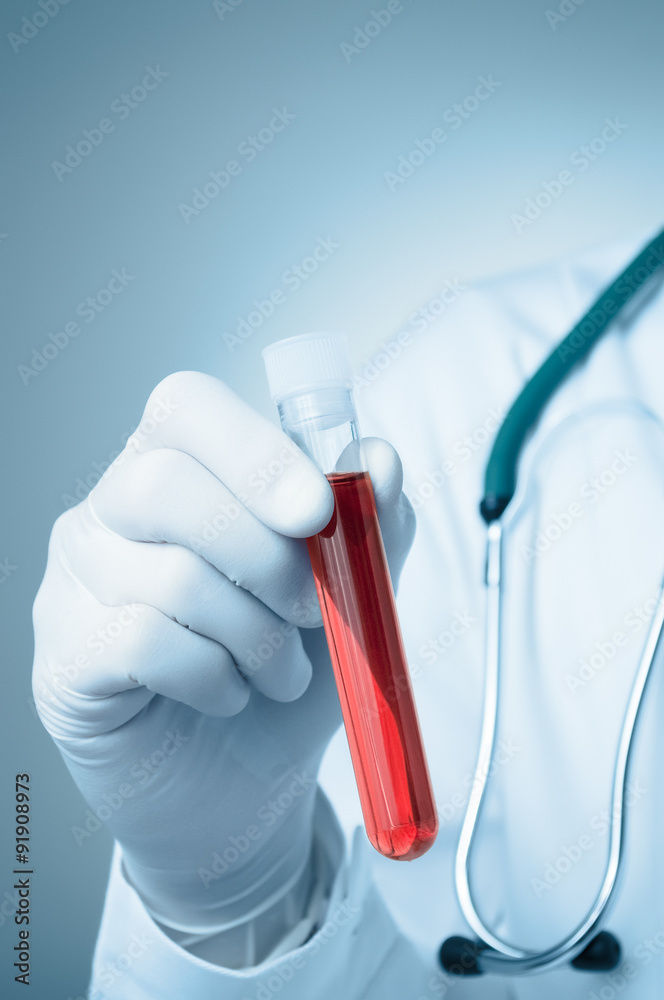 Hand with blood sample Hand with blood sample