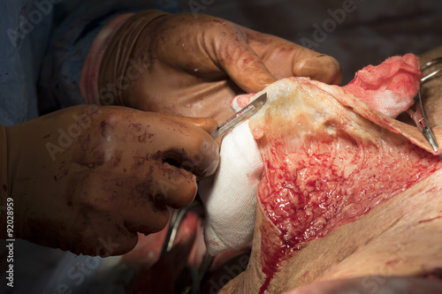 Purify the pelt using scalpel