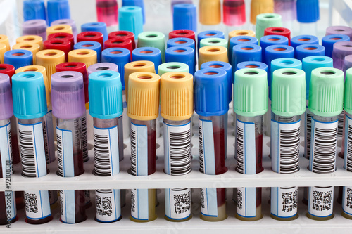 фотографія blood tubes in rack in the lab /blood tube test for analysis in the laboratory o