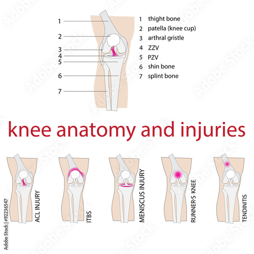 vector illustration of knee anatomy with description and injuries