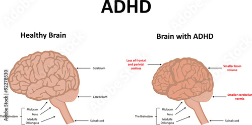 Tapety artystyczne ADHD