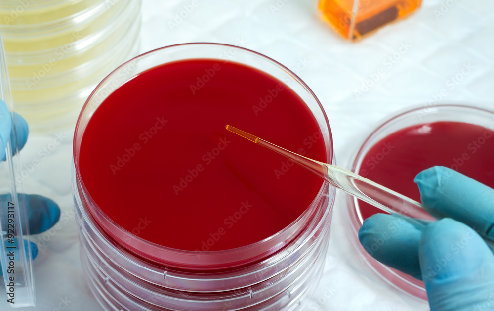 scientific depositing a sample pipetted into a petri plate /microbiologist cultivating a petrie dish whit pipette scientific depositing a sample pipetted into a petri plate /microbiologist cultivating a petrie dish whit pipette