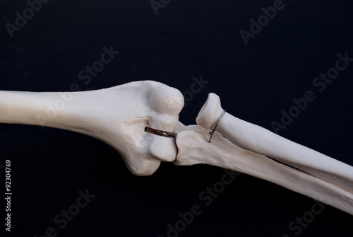 Elbow Joint 