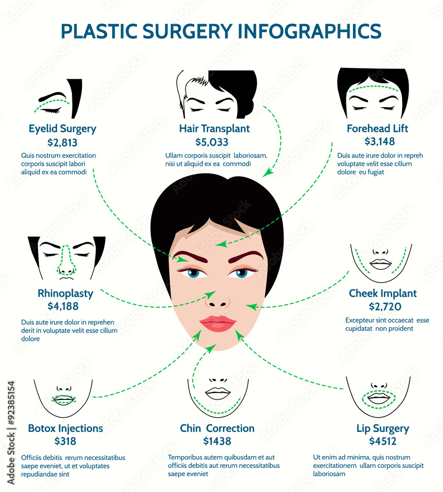 Plastic surgery infographics Stock Vector | Adobe Stock