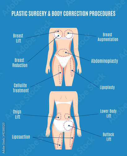 Plastic surgery  body correction vector illustration. Lifting