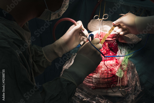neurosurgeon remove brain tumor photo
