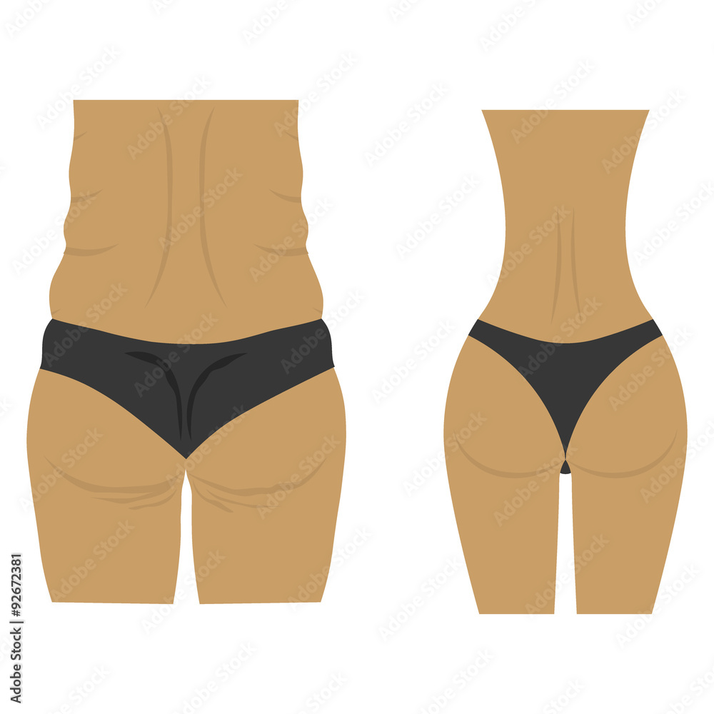 Fat ass and slim ass after diet Stock Vector | Adobe Stock