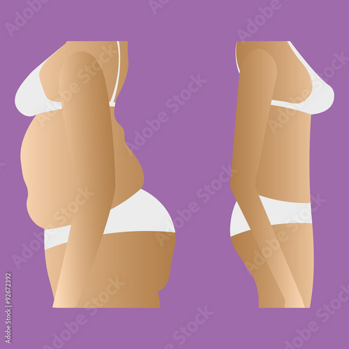 Illustration of thick and thin girls body