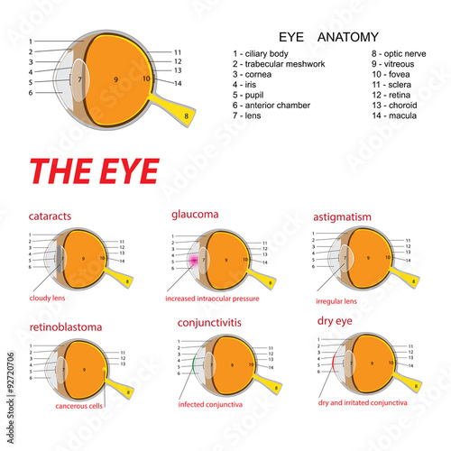 vector illustration of human eye anatomy and diseases 