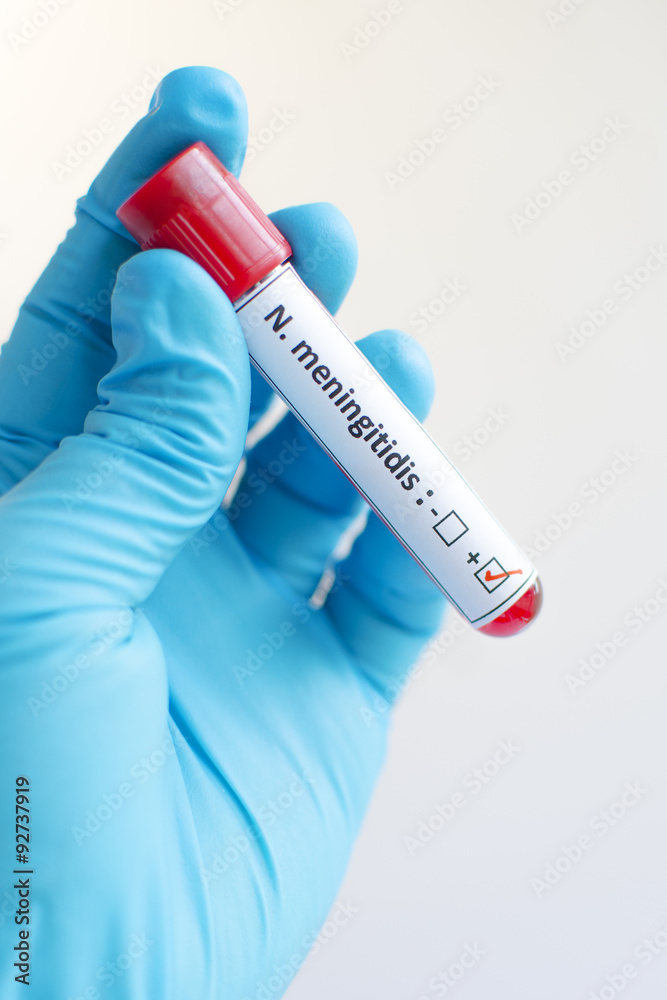 Obraz premium Blood sample with Neisseria meningitides positive