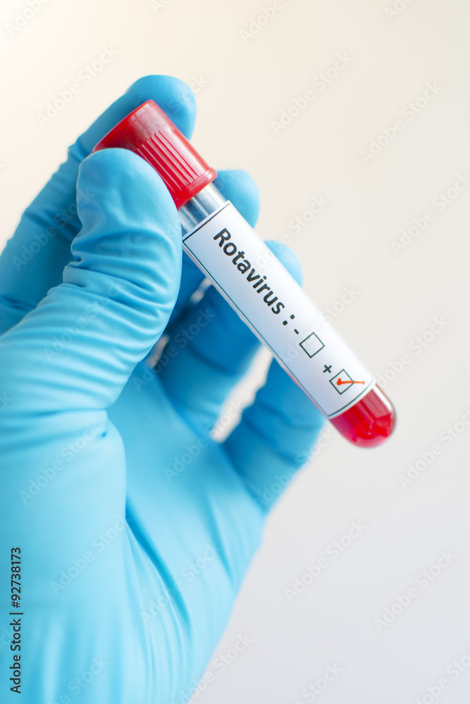 Fototapeta premium Rotavirus blood sample