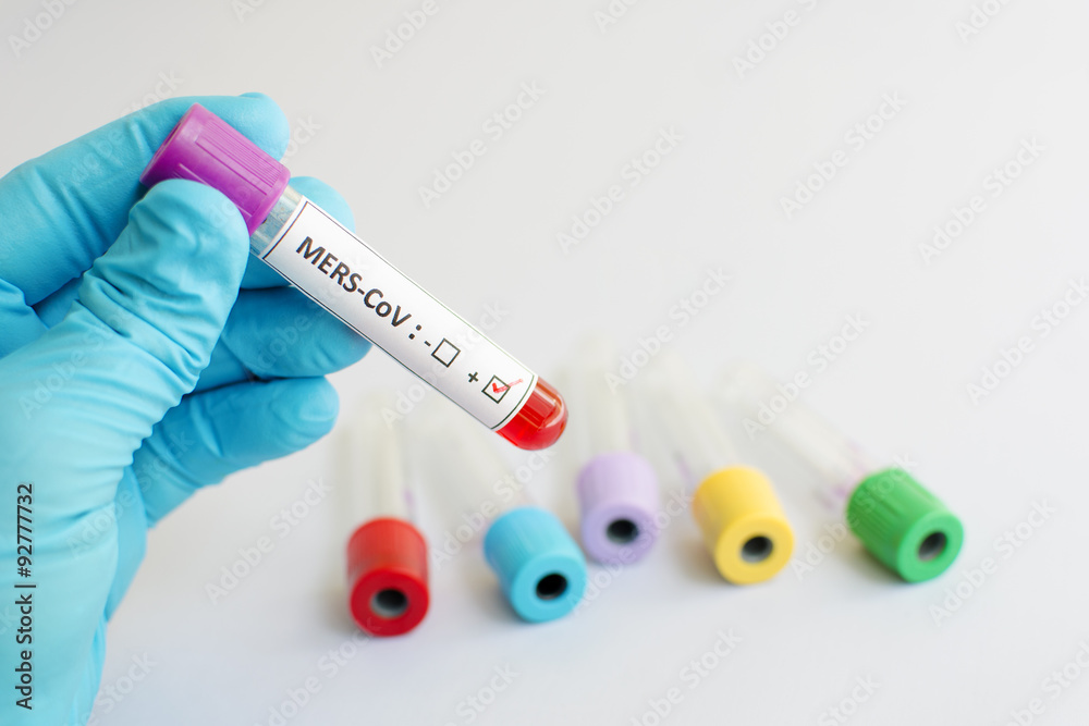 Fototapeta premium Blood sample with MERS virus