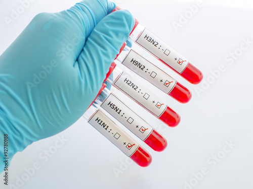 Influenza blood sample photo