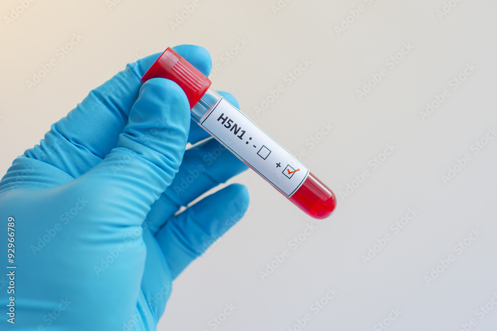 Fototapeta premium H5N1 influenza virus positive