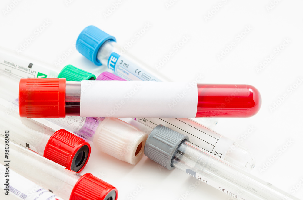 vacuum tubes for collecting and blood samples. vacuum tubes for collecting and blood samples.