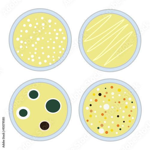 four petri dishes with different microbiological cultures grown