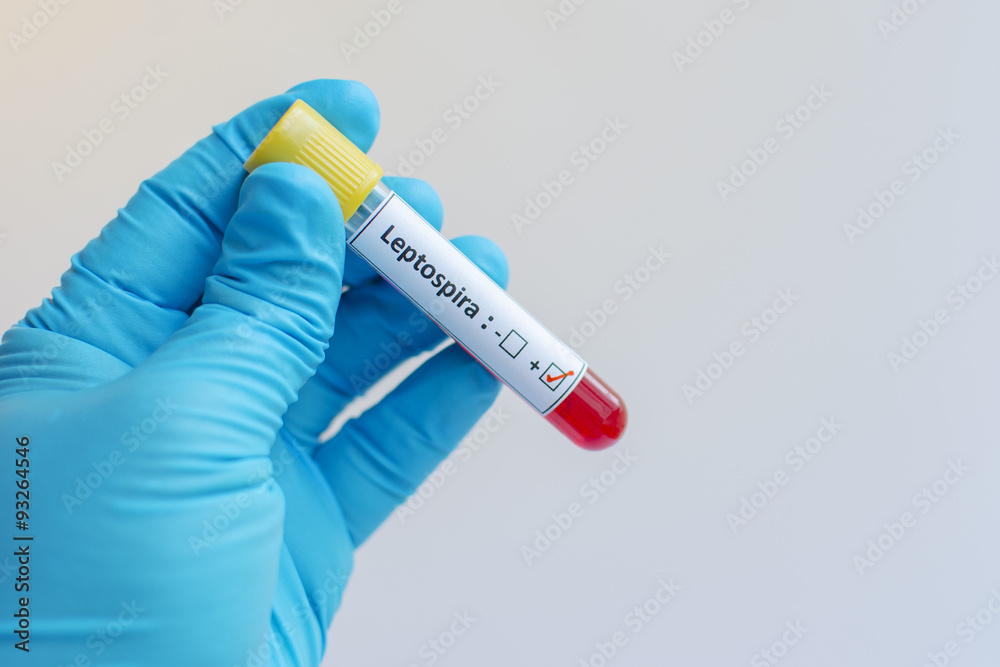 Obraz premium Leptospira blood sample