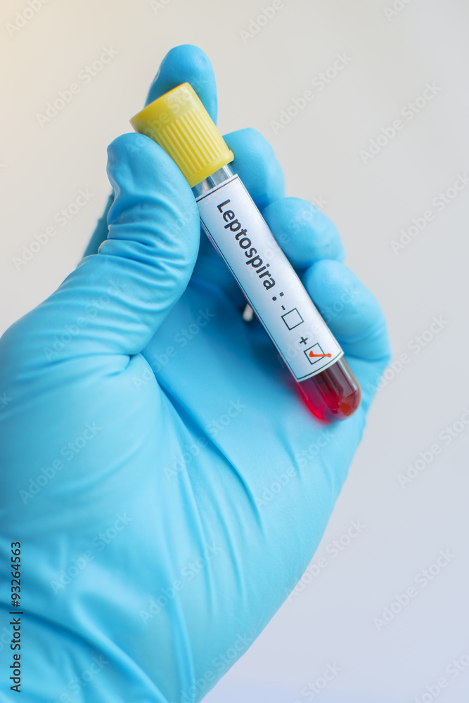Obraz premium Leptospira blood sample