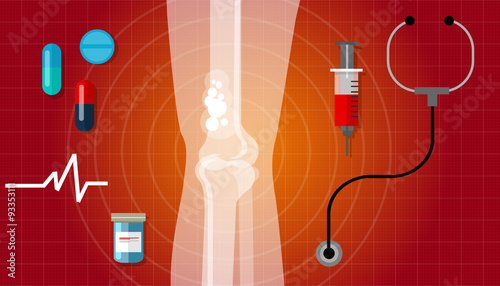 bone cancer health medication anatomy medical care cure 