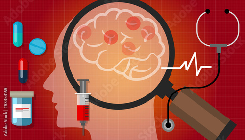 alzheimer parkinson brain cancer medication anatomy medical