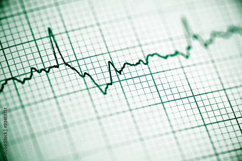 Electrocardiogram Electrocardiogram