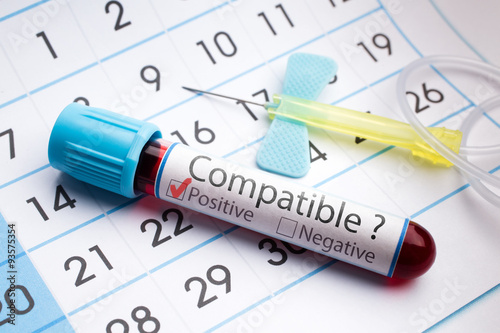 Obraz na plátně tube test with label compatible blood donor /planning calendar and blood sample