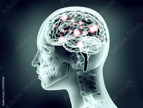 xray image of human head with brain and electric pulses