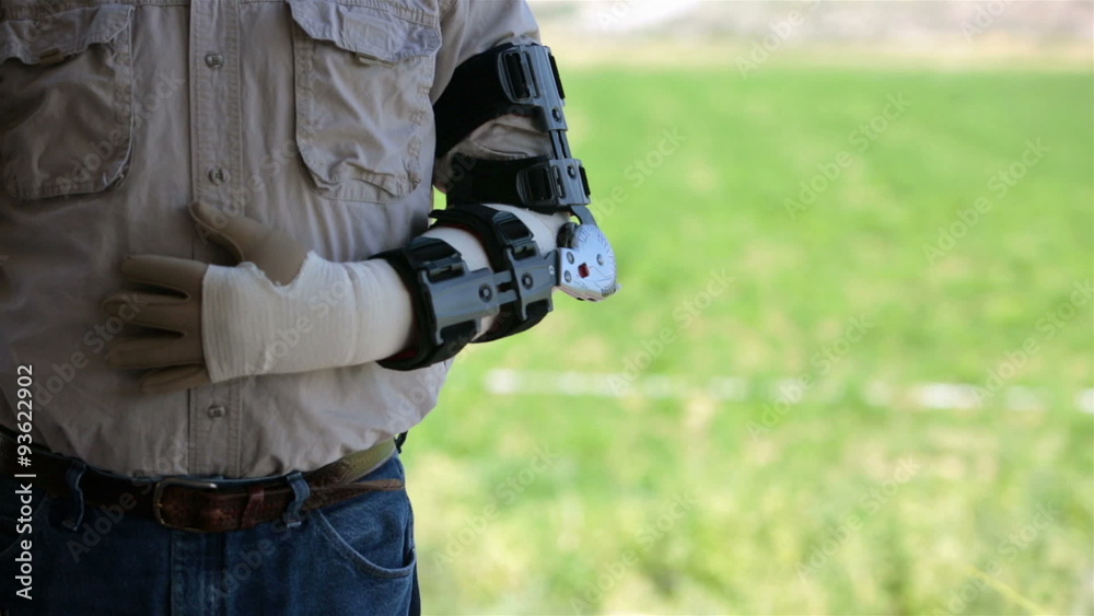 Medical man in arm brace after surgery HD 8224 Medical man in arm brace after surgery HD 8224