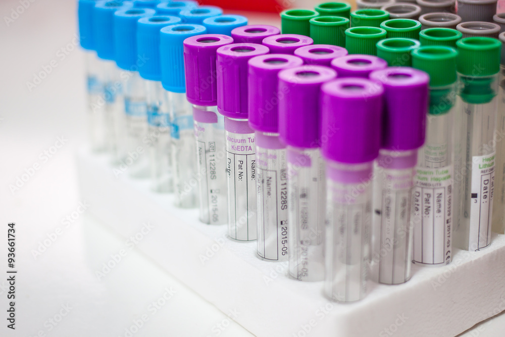 test tubes for testing test tubes for testing