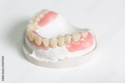 Prothesensattel mit Zahnersatz im Zahntechnischen Labor