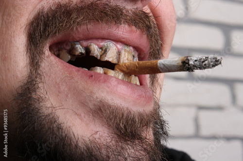Bad teeth smoker sick