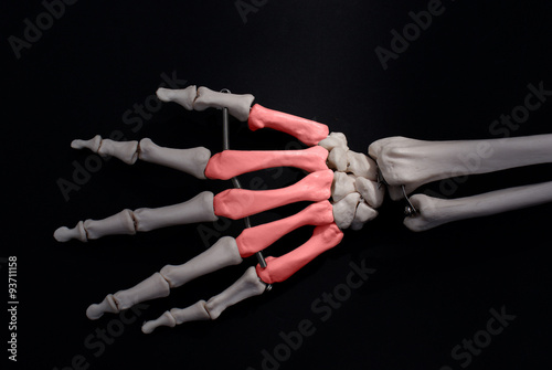 Metacarpal Bones photo