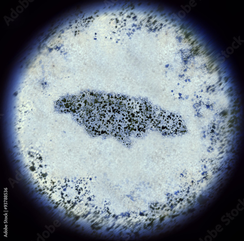 Bacterias in the shape of Jamaica viewed through a microscope.(s photo