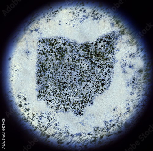 Bacterias in the shape of Ohio viewed through a microscope.(seri photo