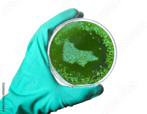 Germs in the shape of Victoria in a petri dish.(series)